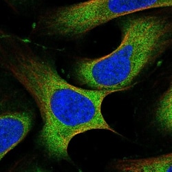PLC-gamma 1 Antibody, Novus Biologicals 0.1mL; Unlabeled:Antibodies, Polyclonal